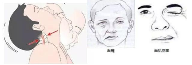 女孩行走姿势怪异,少女走路姿势怪异