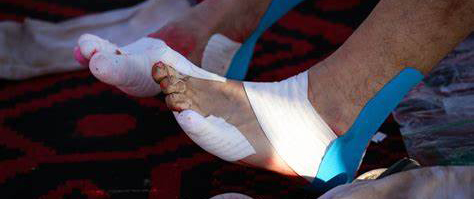 马拉松跑步乳贴,适合跑马拉松的神器