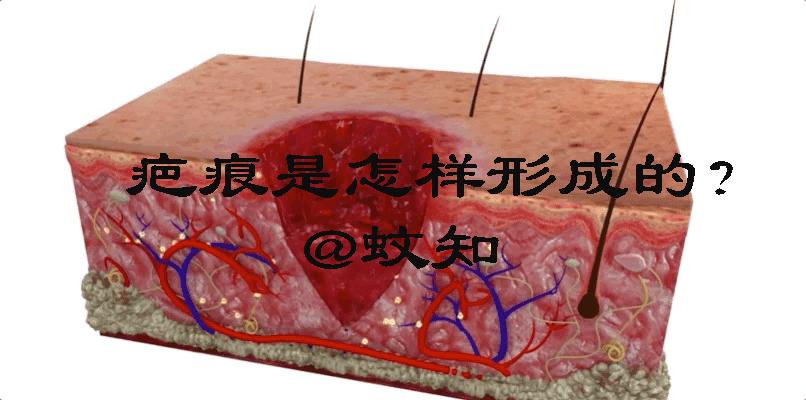 怎么恢复愈合伤口留下的疤痕,科普短片伤口是如何愈合的