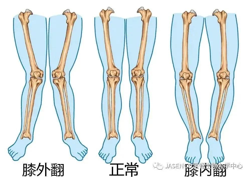 下肢不舒服查什么科,下肢不舒服做什么检查