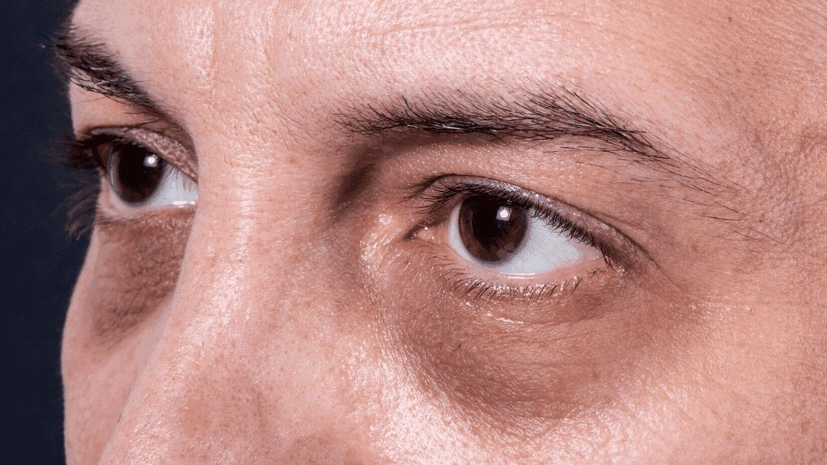 眼睛没有细纹需要眼膜吗,眼膜有用吗能去皱纹吗