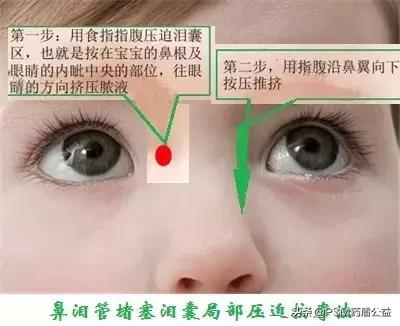 常见眼科疾病是什么病毒引起的,眼科疾病有哪些症状