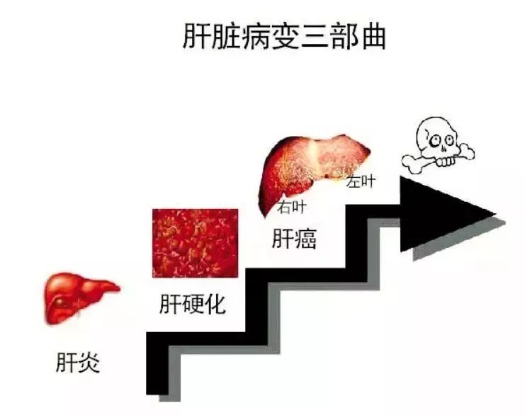 如何提高抗病毒治疗的能力,过早抗病毒治疗的严重后果是什么