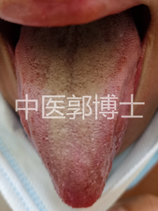 黄带多用什么药能治,黄带多中医怎么治疗