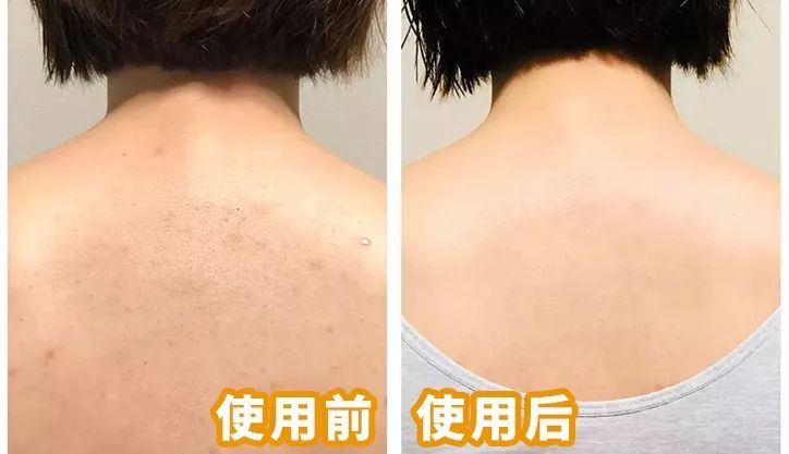 李佳琦推荐澳洲goat羊奶皂,李佳琦推荐黄黑皮克星