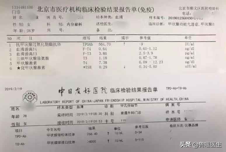 甲亢合并甲癌为什么要全切,甲亢合并甲状腺肿大怎么治疗