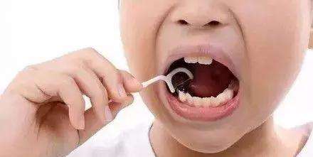 孩子出现双排牙该怎么办,孩子出双排牙怎么办