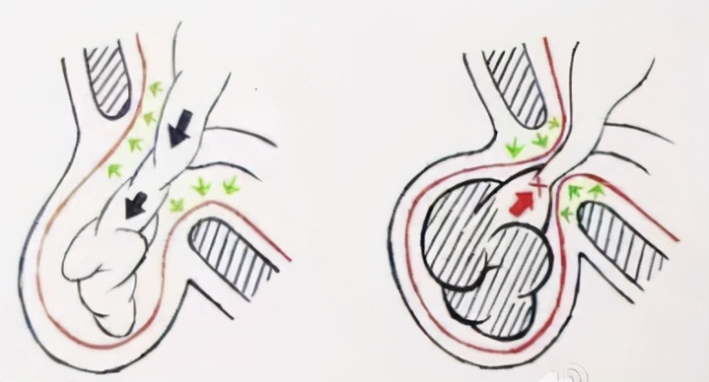 肝移植术后肝功能异常,肝移植术后为啥这么虚弱