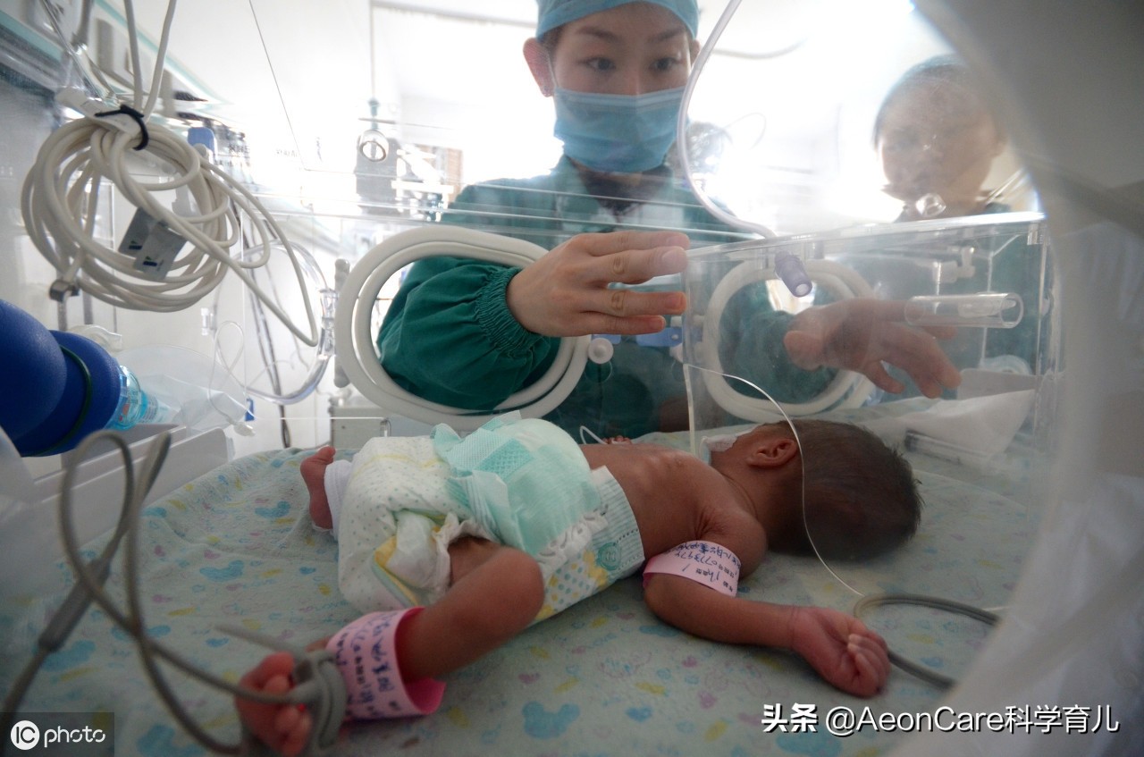 早产儿红屁屁用什么,早产儿尿不湿红屁股