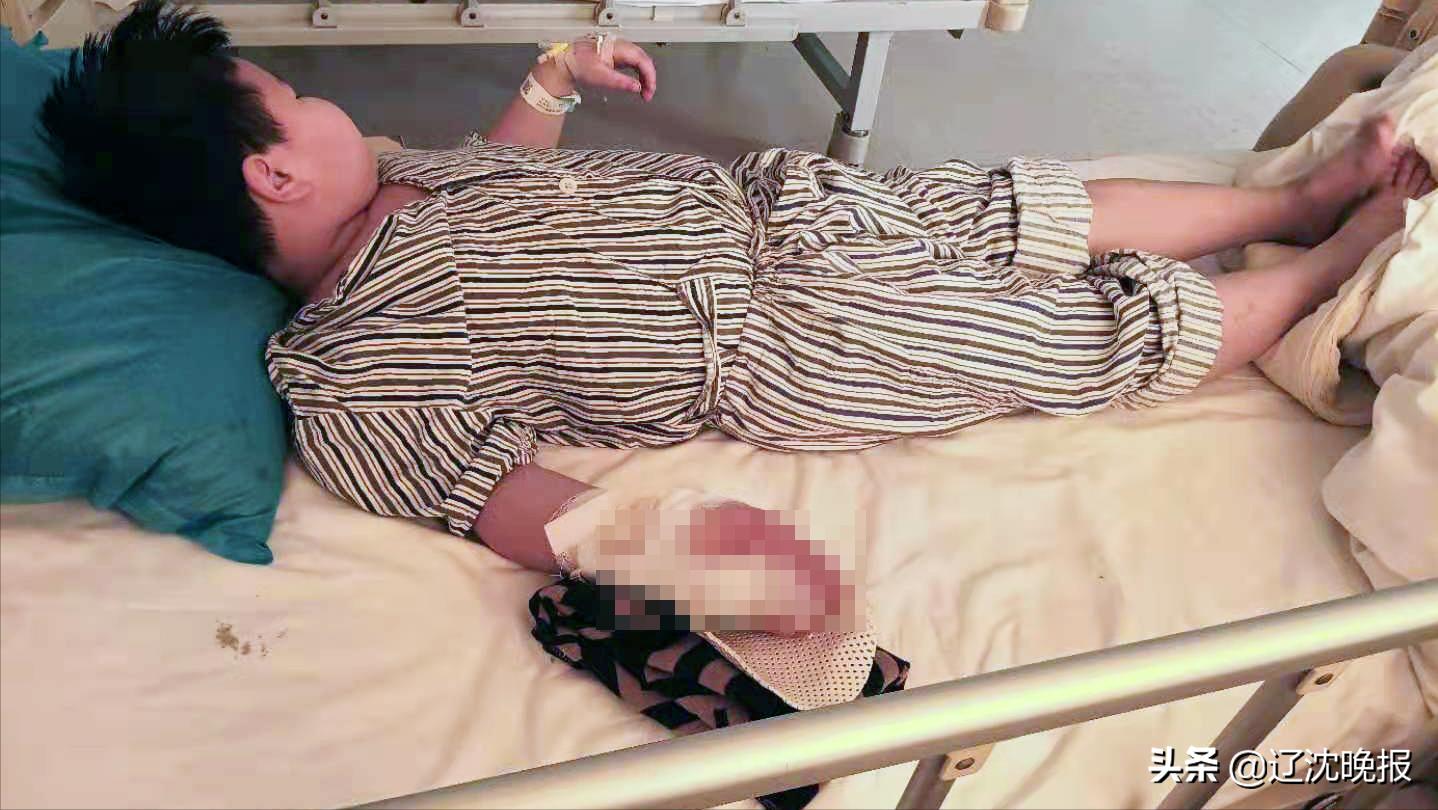 二踢脚把小孩手炸没了,小男孩玩二踢脚被炸掉了手