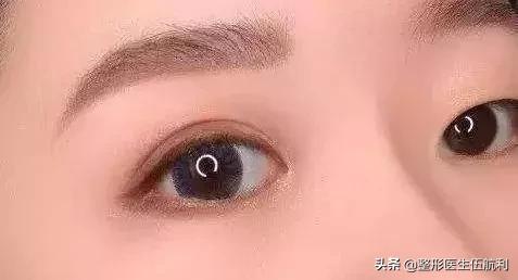 眼睛小应该做哪些眼综合手术,眼睛不对称怎么矫正医美