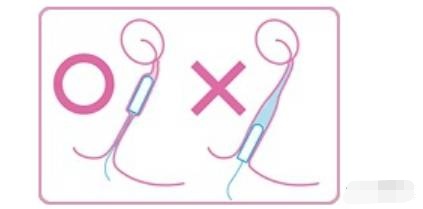 不用姨妈巾的后果,大姨妈来了又没戴姨妈巾怎么解决