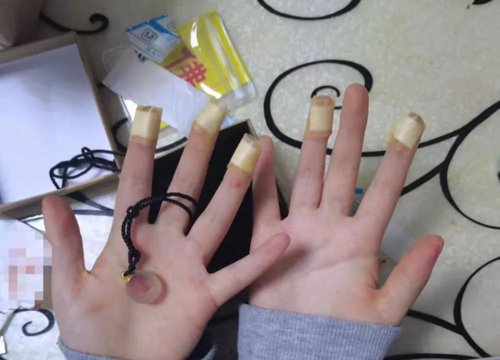 放血后要多久恢复血量,放血救兄弟