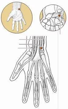 一招解决睡落枕,落枕后怎么睡能缓解疼痛