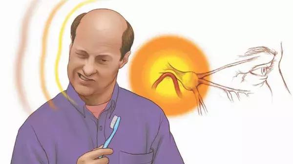 「针知识」三叉神经疼痛难忍,试试这个针灸疗法