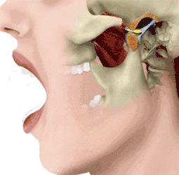 王源下颌骨脱位怎么回事,王源下颌骨脱位手术做了吗