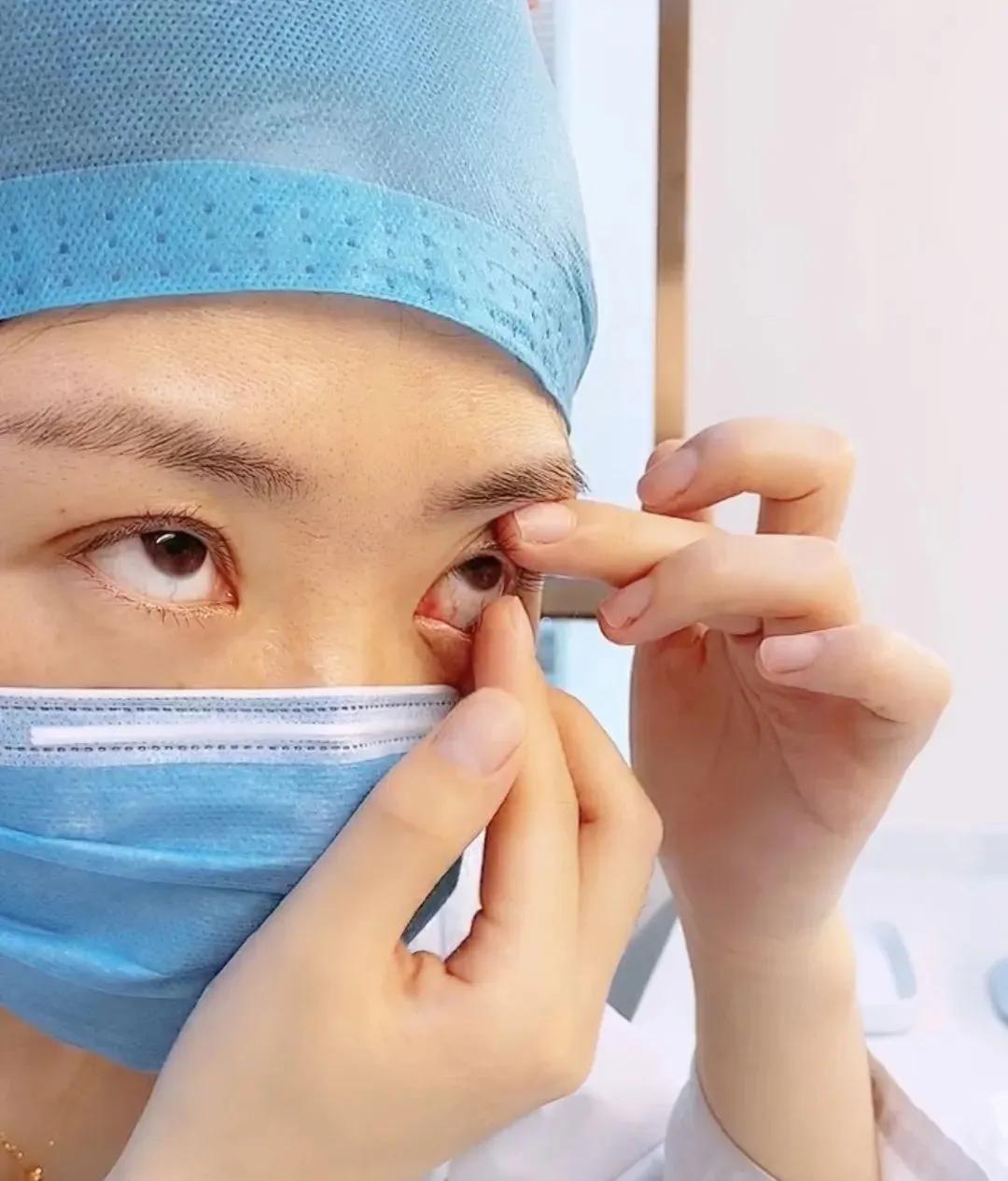 隐形应该怎么摘,专业方法在这里