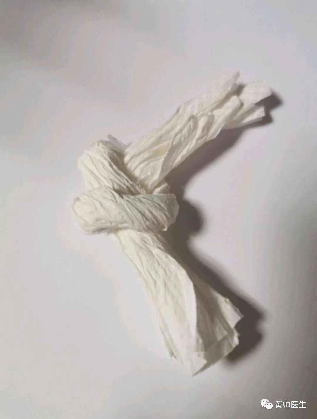 脐带疑似打结,脐带打结科普视频