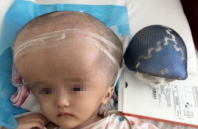 大头娃娃假奶粉事件真实视频,最新大头娃娃奶粉事件