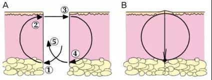脸上有痣但不想点怎么弄掉,脸上很多痣遮不住