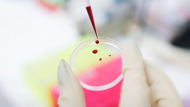 科学家都想拥有的“黄*血金**”，全球仅43人拥有，是真正的万能血