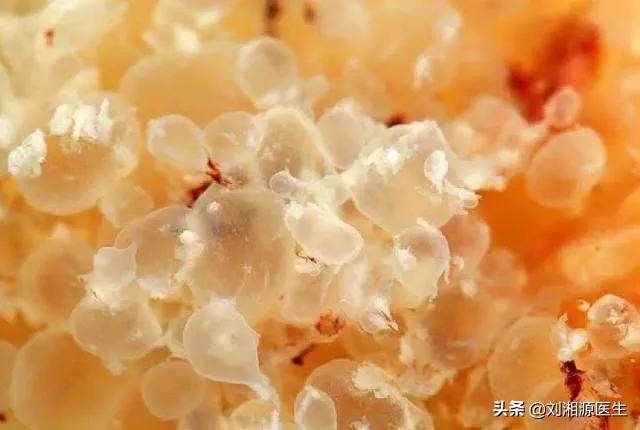 孕期反复流血跟免疫有关系吗,免疫相关不良妊娠答疑解惑