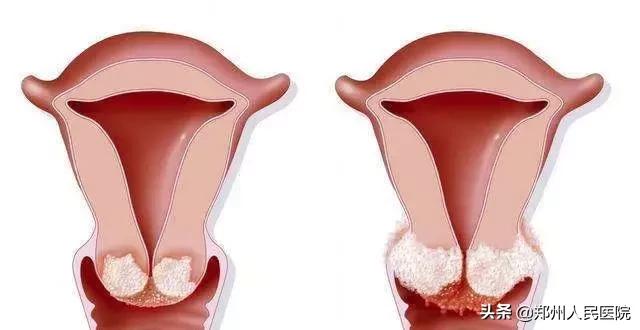 怀孕了经常出血是啥情况,怀孕了经常出血怎么回事
