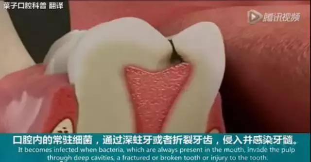 上牙龈上火突出一个鼓包,牙龈肿胀鼓包上火了吗