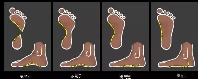 以前运动鞋,运动鞋你买对了吗