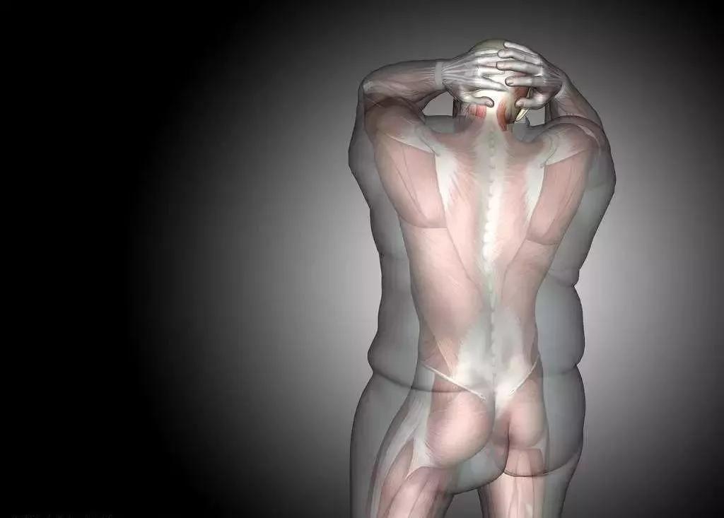 想除掉脂肪粒,想要彻底减肥