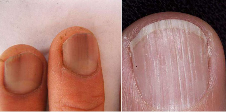 韩国最新美甲神器,最新韩国美甲神器