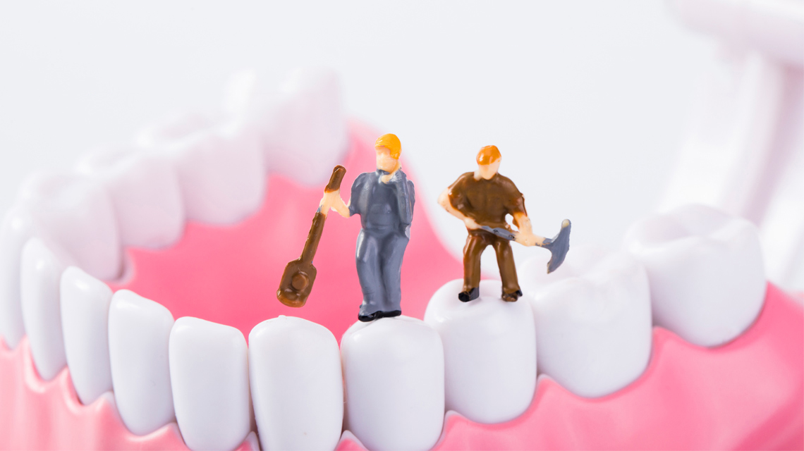 3d打印种植牙与传统种植牙的区别,种植牙是怎样种植的如何操作