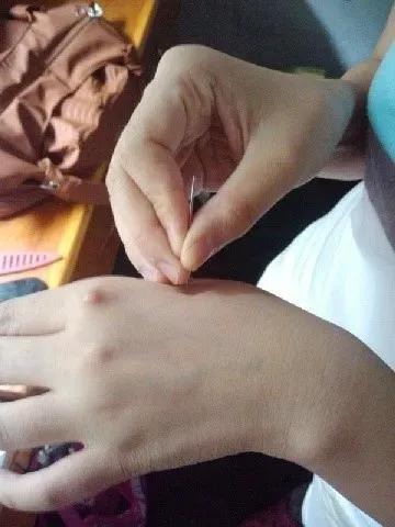 针灸推拿专业咋样有前景吗,针灸推拿专业本科大三课程