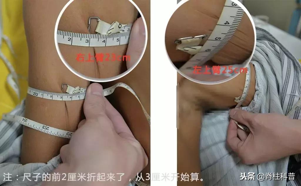 颈椎病治疗的分享,关于颈椎病通俗易懂的科普