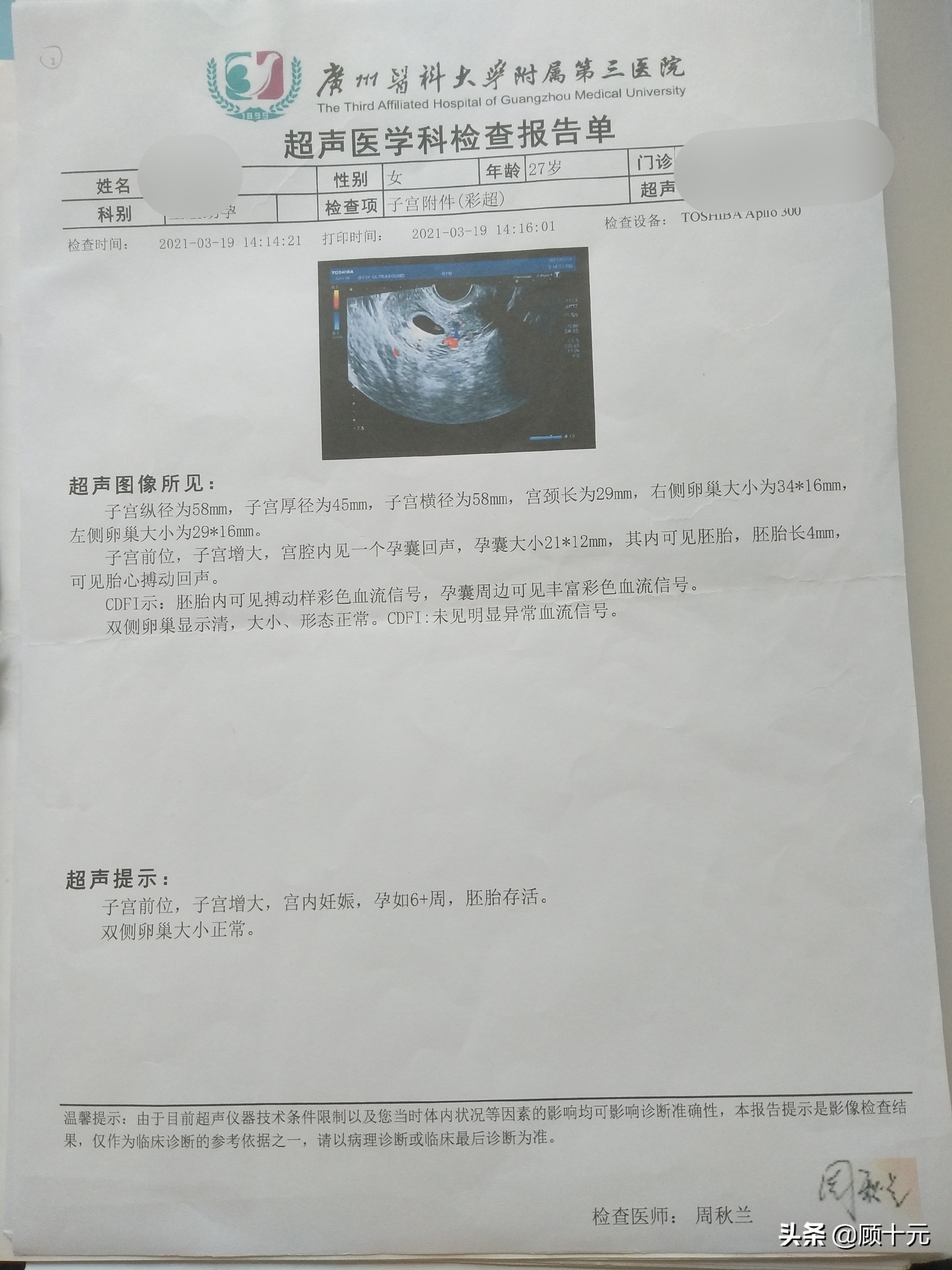 做试管婴儿的全部费用大概是多少,试管婴儿花费广州地区