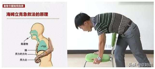 异物卡喉海姆立克急救法视频,异物卡喉用海姆立克急救法