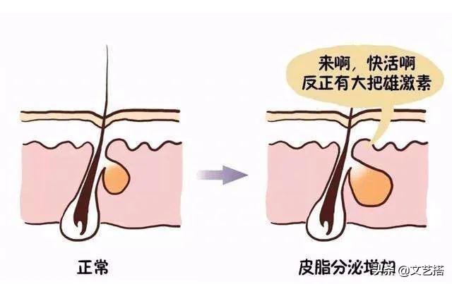 发量多又蓬松又粗怎么护理,女生如何养成细软蓬松发质