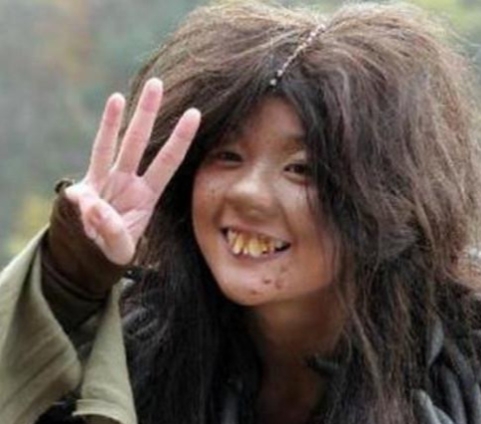 盘点影视剧中五大龅牙,阴阳脸朱顶红