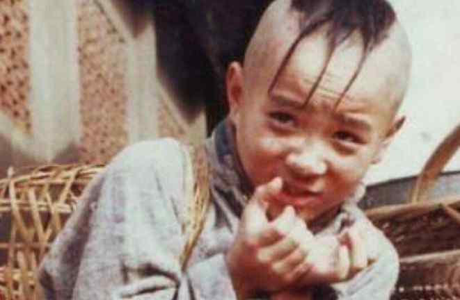 “三毛”34岁了！8岁爆火，14岁谢顶，植发挨300多针，如今变帅哥