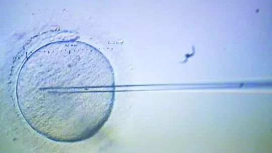 45岁冷冻卵子,28岁女生冻卵