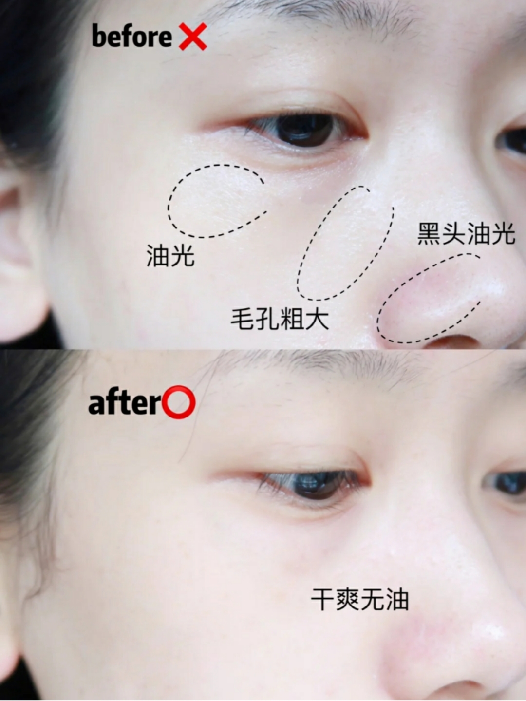 美容仪好用度真实测评,美容仪使用一个月测评