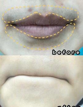 嘴唇黑的女人,嘴唇发黑的女人好不好