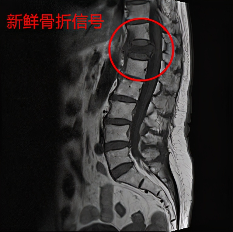 翻身疼深呼吸疼是怎么回事,向左翻身疼是怎么回事