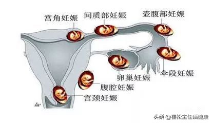 不想去医院第三弹！腹部不适的自我诊察