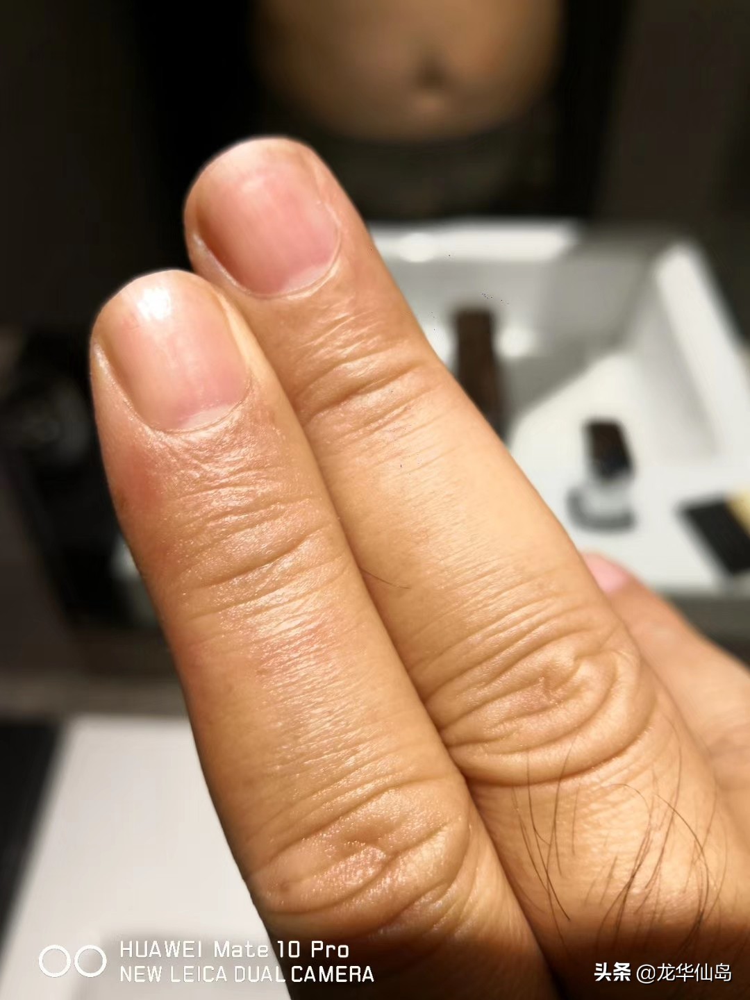 蟒蛇油使用案例与方法