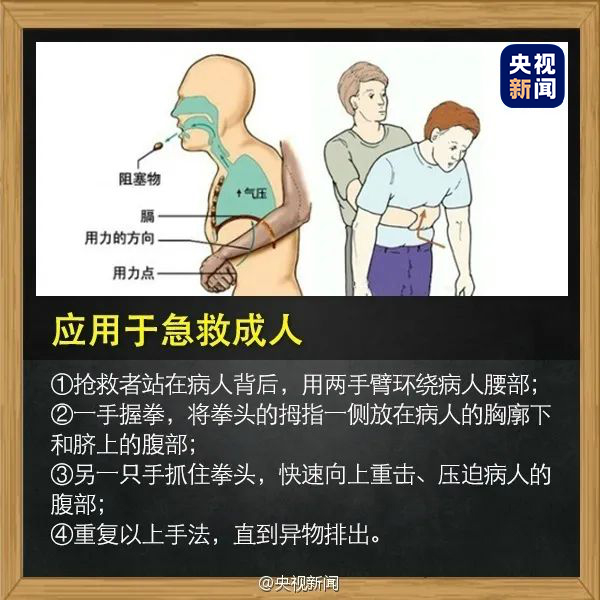 儿童异物卡喉梗阻窒息急救法,孩子被异物卡喉怎么做手术