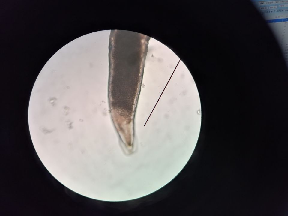 春季小心这些传染病,春季常见疾病预防及护理