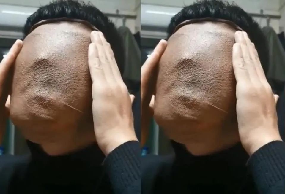 男生敷面膜似兵马俑,男生敷面膜室友乐翻称像兵马俑