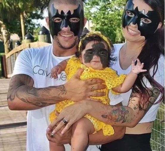 胎记女孩一夜爆红,胎记女孩手术前后对比