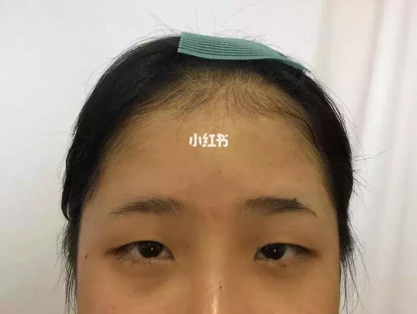 单眼皮的女生还是双眼皮的好看,单眼皮女生必须是双眼皮才好看吗